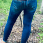 Shark Bite Ankle Skinny Jeans